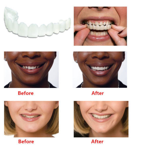 Teeth Whitening Snap On Smile Teeth Cosmetic Denture Instant Perfect Smile Teeth Fake Tooth Cover One Size Fits