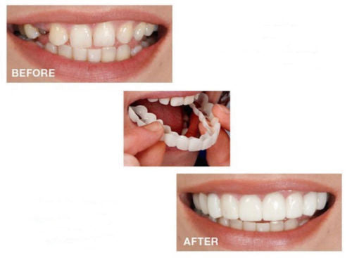 Teeth Whitening Snap On Smile Teeth Cosmetic Denture Instant Perfect Smile Teeth Fake Tooth Cover One Size Fits